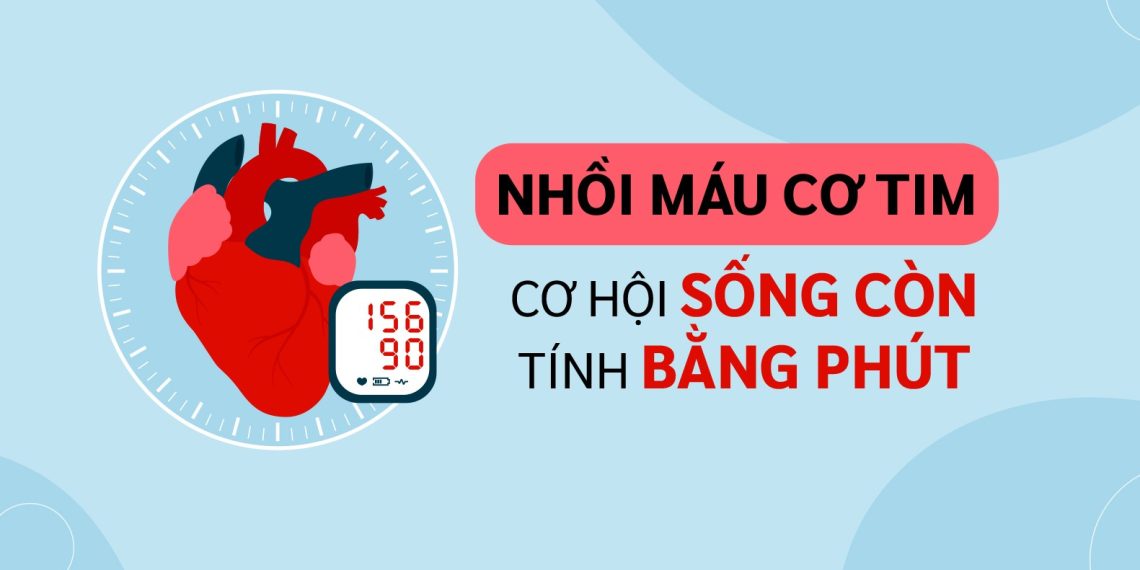 NHỒI MÁU CƠ TIM – CƠ HỘI SỐNG CÒN TÍNH BẰNG PHÚT