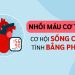NHỒI MÁU CƠ TIM – CƠ HỘI SỐNG CÒN TÍNH BẰNG PHÚT